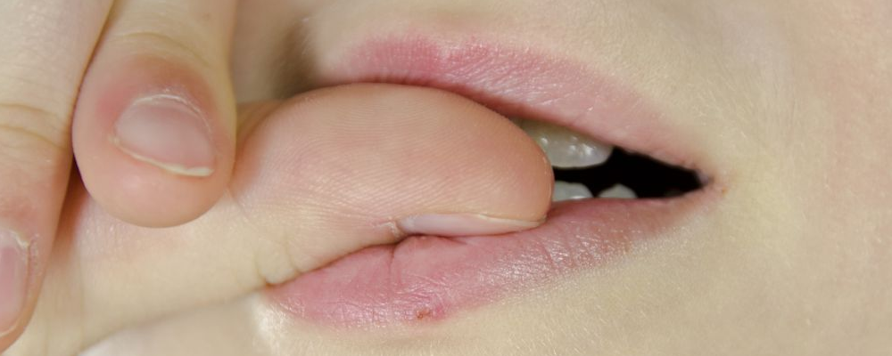 冬天嘴唇干裂是缺少维生素吗 冬天嘴唇干裂该怎么办 嘴唇干裂怎么治疗
